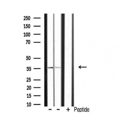 DF3638 staining HuvEc by IF/ICC. The sample were fixed with PFA and permeabilized in 0.1% Triton X-100,then blocked in 10% serum for 45 minutes at 25¡ãC. The primary antibody was diluted at 1/200 and incubated with the sample for 1 hour at 37¡ãC. An  Alexa Fluor 594 conjugated goat anti-rabbit IgG (H+L) Ab, diluted at 1/600, was used as the secondary antibod