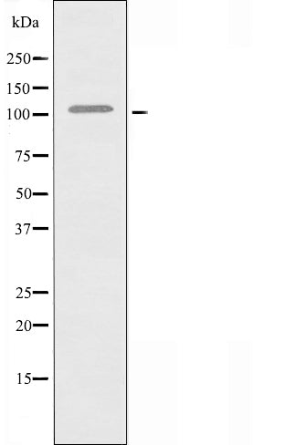DF3639 at 1/100 staining Human breast cancer tissue by IHC-P. The sample was formaldehyde fixed and a heat mediated antigen retrieval step in citrate buffer was performed. The sample was then blocked and incubated with the antibody for 1.5 hours at 22¡ãC. An HRP conjugated goat anti-rabbit antibody was used as the secondary