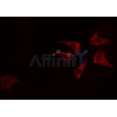 DF3640 staining Hela by IF/ICC. The sample were fixed with PFA and permeabilized in 0.1% Triton X-100,then blocked in 10% serum for 45 minutes at 25¡ãC. The primary antibody was diluted at 1/200 and incubated with the sample for 1 hour at 37¡ãC. An  Alexa Fluor 594 conjugated goat anti-rabbit IgG (H+L) Ab, diluted at 1/600, was used as the secondary antibod