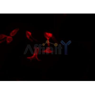 Western blot analysis of extracts from Hela, using AGPAT5 Antibody.