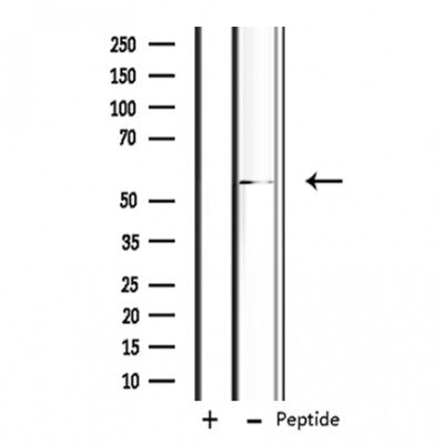 Western blot analysis of extracts from rat brain, using PSMD12 Antibody.