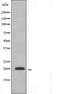 DF3646 staining Hela by IF/ICC. The sample were fixed with PFA and permeabilized in 0.1% Triton X-100,then blocked in 10% serum for 45 minutes at 25¡ãC. The primary antibody was diluted at 1/200 and incubated with the sample for 1 hour at 37¡ãC. An  Alexa Fluor 594 conjugated goat anti-rabbit IgG (H+L) Ab, diluted at 1/600, was used as the secondary antibod