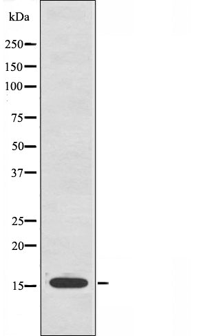 DF3647 at 1/100 staining Mouse muscle tissue by IHC-P. The sample was formaldehyde fixed and a heat mediated antigen retrieval step in citrate buffer was performed. The sample was then blocked and incubated with the antibody for 1.5 hours at 22¡ãC. An HRP conjugated goat anti-rabbit antibody was used as the secondary