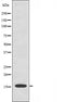 DF3647 at 1/100 staining Mouse muscle tissue by IHC-P. The sample was formaldehyde fixed and a heat mediated antigen retrieval step in citrate buffer was performed. The sample was then blocked and incubated with the antibody for 1.5 hours at 22¡ãC. An HRP conjugated goat anti-rabbit antibody was used as the secondary