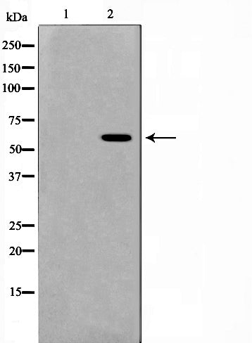 Western blot analysis on HeLa cell lysate using MUTYH Antibody,The lane on the left is treated with the antigen-specific peptide.