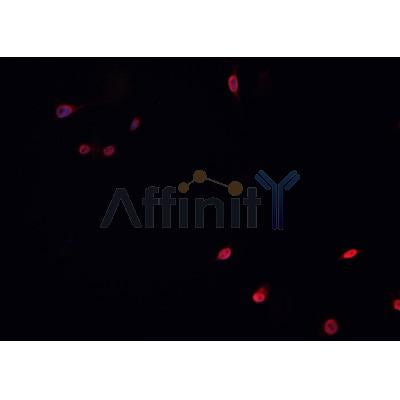 AF0379 staining HeLa  cells by IF/ICC. The sample were fixed with PFA and permeabilized in 0.1% Triton X-100,then blocked in 10% serum for 45 minutes at 25¡ãC. The primary antibody was diluted at 1/200 and incubated with the sample for 1 hour at 37¡ãC. An  Alexa Fluor 594 conjugated goat anti-rabbit IgG (H+L) antibody(Cat.