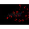 AF0379 staining HeLa by IF/ICC. The sample were fixed with PFA and permeabilized in 0.1% Triton X-100,then blocked in 10% serum for 45 minutes at 25¡ãC. The primary antibody was diluted at 1/200 and incubated with the sample for 1 hour at 37¡ãC. An  Alexa Fluor 594 conjugated goat anti-rabbit IgG (H+L) Ab, diluted at 1/600, was used as the secondary antibod