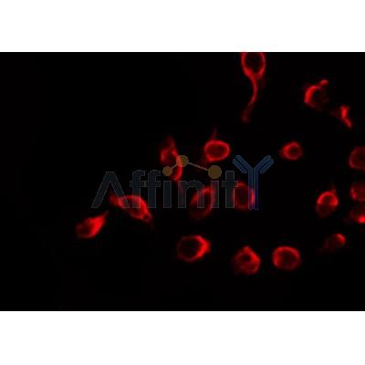 AF0379 staining HeLa by IF/ICC. The sample were fixed with PFA and permeabilized in 0.1% Triton X-100,then blocked in 10% serum for 45 minutes at 25¡ãC. The primary antibody was diluted at 1/200 and incubated with the sample for 1 hour at 37¡ãC. An  Alexa Fluor 594 conjugated goat anti-rabbit IgG (H+L) Ab, diluted at 1/600, was used as the secondary antibod