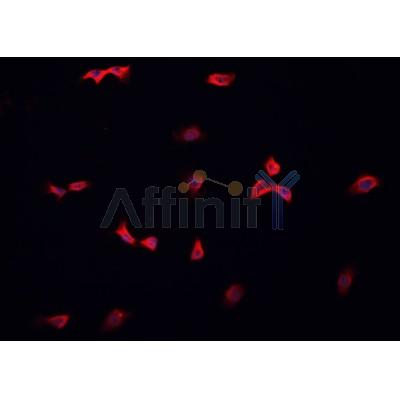 AF0202 staining HeLa cells by IF/ICC. The sample were fixed with PFA and permeabilized in 0.1% Triton X-100,then blocked in 10% serum for 45 minutes at 25¡ãC. The primary antibody was diluted at 1/200 and incubated with the sample for 1 hour at 37¡ãC. An  Alexa Fluor 594 conjugated goat anti-rabbit IgG (H+L) antibody(Cat.