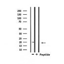 Western blot analysis of extracts from mosue lung, using Mammaglobin Antibody.