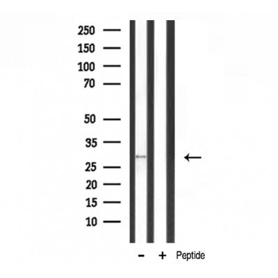 DF3655 staining 293 by IF/ICC. The sample were fixed with PFA and permeabilized in 0.1% Triton X-100,then blocked in 10% serum for 45 minutes at 25¡ãC. The primary antibody was diluted at 1/200 and incubated with the sample for 1 hour at 37¡ãC. An  Alexa Fluor 594 conjugated goat anti-rabbit IgG (H+L) Ab, diluted at 1/600, was used as the secondary antibod