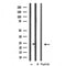Western blot analysis of extracts from 293 and hela and rat brain, using MRPL11 Antibody.