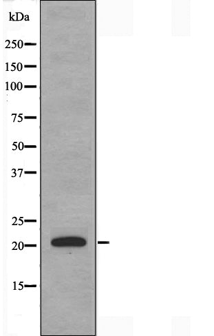 DF3657 staining COLO205 by IF/ICC. The sample were fixed with PFA and permeabilized in 0.1% Triton X-100,then blocked in 10% serum for 45 minutes at 25¡ãC. The primary antibody was diluted at 1/200 and incubated with the sample for 1 hour at 37¡ãC. An  Alexa Fluor 594 conjugated goat anti-rabbit IgG (H+L) Ab, diluted at 1/600, was used as the secondary antibod