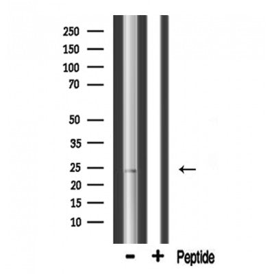 DF3658 at 1/100 staining Mouse muscle tissue by IHC-P. The sample was formaldehyde fixed and a heat mediated antigen retrieval step in citrate buffer was performed. The sample was then blocked and incubated with the antibody for 1.5 hours at 22¡ãC. An HRP conjugated goat anti-rabbit antibody was used as the secondary