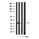Western blot analysis of extracts from 293, using MRPL16 Antibody. Lane 1 was treated with the antigen-specific peptide.