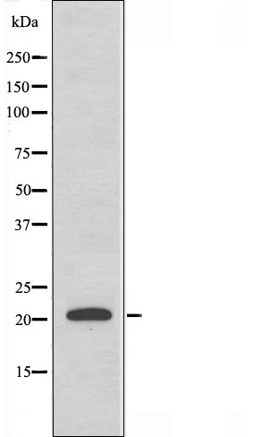 DF3662 staining HT29 by IF/ICC. The sample were fixed with PFA and permeabilized in 0.1% Triton X-100,then blocked in 10% serum for 45 minutes at 25¡ãC. The primary antibody was diluted at 1/200 and incubated with the sample for 1 hour at 37¡ãC. An  Alexa Fluor 594 conjugated goat anti-rabbit IgG (H+L) Ab, diluted at 1/600, was used as the secondary antibod