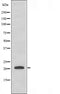 DF3662 staining HT29 by IF/ICC. The sample were fixed with PFA and permeabilized in 0.1% Triton X-100,then blocked in 10% serum for 45 minutes at 25¡ãC. The primary antibody was diluted at 1/200 and incubated with the sample for 1 hour at 37¡ãC. An  Alexa Fluor 594 conjugated goat anti-rabbit IgG (H+L) Ab, diluted at 1/600, was used as the secondary antibod
