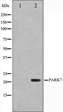 Western blot analysis on HuvEc cell lysate using PARK7 Antibody,The lane on the left is treated with the antigen-specific peptide.