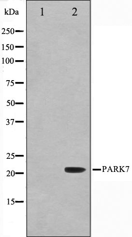 Western blot analysis on HuvEc cell lysate using PARK7 Antibody,The lane on the left is treated with the antigen-specific peptide.