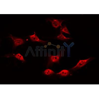AF0380 staining HuvEc by IF/ICC. The sample were fixed with PFA and permeabilized in 0.1% Triton X-100,then blocked in 10% serum for 45 minutes at 25¡ãC. The primary antibody was diluted at 1/200 and incubated with the sample for 1 hour at 37¡ãC. An  Alexa Fluor 594 conjugated goat anti-rabbit IgG (H+L) Ab, diluted at 1/600, was used as the secondary antibod