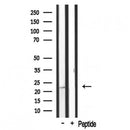 Western blot analysis of extracts from rat brain, using MRPL20 Antibody. Lane 1 was treated with the antigen-specific peptide.