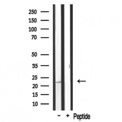 Western blot analysis of extracts from rat brain, using MRPL20 Antibody. Lane 1 was treated with the antigen-specific peptide.
