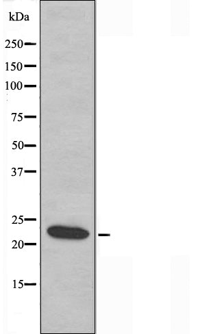 DF3664 at 1/100 staining Mouse muscle tissue by IHC-P. The sample was formaldehyde fixed and a heat mediated antigen retrieval step in citrate buffer was performed. The sample was then blocked and incubated with the antibody for 1.5 hours at 22¡ãC. An HRP conjugated goat anti-rabbit antibody was used as the secondary