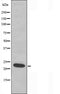 DF3664 at 1/100 staining Mouse muscle tissue by IHC-P. The sample was formaldehyde fixed and a heat mediated antigen retrieval step in citrate buffer was performed. The sample was then blocked and incubated with the antibody for 1.5 hours at 22¡ãC. An HRP conjugated goat anti-rabbit antibody was used as the secondary