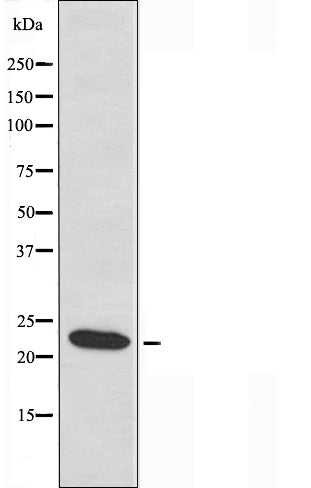 DF3665 staining HepG2 by IF/ICC. The sample were fixed with PFA and permeabilized in 0.1% Triton X-100,then blocked in 10% serum for 45 minutes at 25¡ãC. The primary antibody was diluted at 1/200 and incubated with the sample for 1 hour at 37¡ãC. An  Alexa Fluor 594 conjugated goat anti-rabbit IgG (H+L) Ab, diluted at 1/600, was used as the secondary antibod