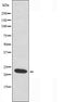 DF3665 staining HepG2 by IF/ICC. The sample were fixed with PFA and permeabilized in 0.1% Triton X-100,then blocked in 10% serum for 45 minutes at 25¡ãC. The primary antibody was diluted at 1/200 and incubated with the sample for 1 hour at 37¡ãC. An  Alexa Fluor 594 conjugated goat anti-rabbit IgG (H+L) Ab, diluted at 1/600, was used as the secondary antibod