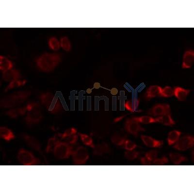 Western blot analysis of extracts from HepG2, using MRPL32 Antibody. Lane 1 was treated with the antigen-specific peptide.