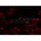 Western blot analysis of extracts from HepG2, using MRPL32 Antibody. Lane 1 was treated with the antigen-specific peptide.