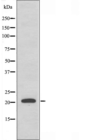DF3670 at 1/100 staining Mouse testis tissue by IHC-P. The sample was formaldehyde fixed and a heat mediated antigen retrieval step in citrate buffer was performed. The sample was then blocked and incubated with the antibody for 1.5 hours at 22¡ãC. An HRP conjugated goat anti-rabbit antibody was used as the secondary