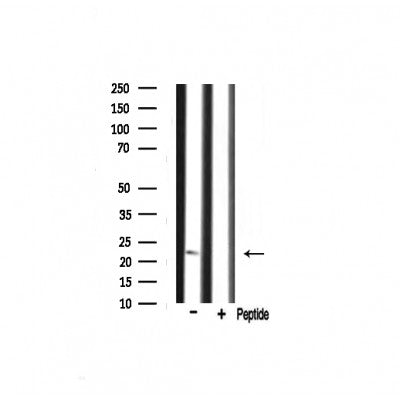 Western blot analysis on mouse liver lysate using RPS9 Antibody