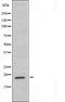 DF3676 staining  HeLa cells by IF/ICC. The sample were fixed with PFA and permeabilized in 0.1% Triton X-100,then blocked in 10% serum for 45 minutes at 25¡ãC. The primary antibody was diluted at 1/200 and incubated with the sample for 1 hour at 37¡ãC. An  Alexa Fluor 594 conjugated goat anti-rabbit IgG (H+L) antibody(Cat.# S0006), diluted at 1/600, was used as secondary antibod