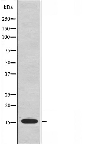 DF3677 staining Hela by IF/ICC. The sample were fixed with PFA and permeabilized in 0.1% Triton X-100,then blocked in 10% serum for 45 minutes at 25¡ãC. The primary antibody was diluted at 1/200 and incubated with the sample for 1 hour at 37¡ãC. An  Alexa Fluor 594 conjugated goat anti-rabbit IgG (H+L) Ab, diluted at 1/600, was used as the secondary antibod