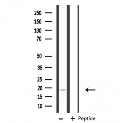 DF3679 staining  Hela cells by IF/ICC. The sample were fixed with PFA and permeabilized in 0.1% Triton X-100,then blocked in 10% serum for 45 minutes at 25¡ãC. The primary antibody was diluted at 1/200 and incubated with the sample for 1 hour at 37¡ãC. An  Alexa Fluor 594 conjugated goat anti-rabbit IgG (H+L) antibody(Cat.# S0006), diluted at 1/600, was used as secondary antibod
