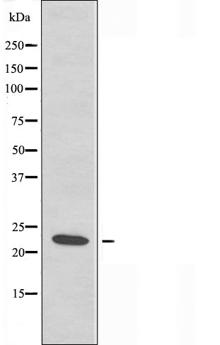 Western blot analysis of extracts from JurKat cells using RPS7 antibody.