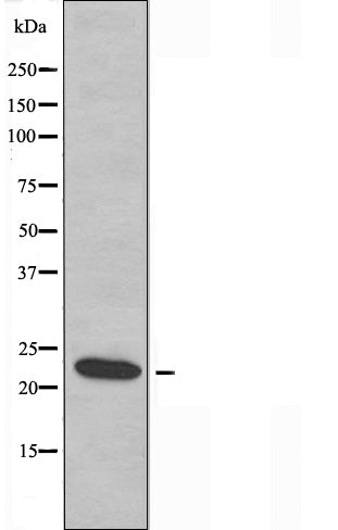 DF3690 staining  HepG2 cells by IF/ICC. The sample were fixed with PFA and permeabilized in 0.1% Triton X-100,then blocked in 10% serum for 45 minutes at 25¡ãC. The primary antibody was diluted at 1/200 and incubated with the sample for 1 hour at 37¡ãC. An  Alexa Fluor 594 conjugated goat anti-rabbit IgG (H+L) antibody(Cat.# S0006), diluted at 1/600, was used as secondary antibod