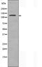 DF3692 at 1/100 staining Human cervical cancer tissue by IHC-P. The sample was formaldehyde fixed and a heat mediated antigen retrieval step in citrate buffer was performed. The sample was then blocked and incubated with the antibody for 1.5 hours at 22¡ãC. An HRP conjugated goat anti-rabbit antibody was used as the secondary