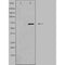 DF3693 staining  A549 cells by IF/ICC. The sample were fixed with PFA and permeabilized in 0.1% Triton X-100,then blocked in 10% serum for 45 minutes at 25¡ãC. The primary antibody was diluted at 1/200 and incubated with the sample for 1 hour at 37¡ãC. An  Alexa Fluor 594 conjugated goat anti-rabbit IgG (H+L) antibody(Cat.# S0006), diluted at 1/600, was used as secondary antibod