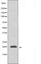 DF3695 staining  Hela cells by IF/ICC. The sample were fixed with PFA and permeabilized in 0.1% Triton X-100,then blocked in 10% serum for 45 minutes at 25¡ãC. The primary antibody was diluted at 1/200 and incubated with the sample for 1 hour at 37¡ãC. An  Alexa Fluor 594 conjugated goat anti-rabbit IgG (H+L) antibody(Cat.# S0006), diluted at 1/600, was used as secondary antibod