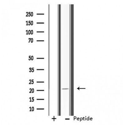 Western blot analysis of extracts from Rat  brain, using RPL11 Antibody. The lane on the left was treated with blocking peptide.