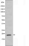 DF3697 staining HepG2 cells by IF/ICC. The sample were fixed with PFA and permeabilized in 0.1% Triton X-100,then blocked in 10% serum for 45 minutes at 25¡ãC. The primary antibody was diluted at 1/200 and incubated with the sample for 1 hour at 37¡ãC. An  Alexa Fluor 594 conjugated goat anti-rabbit IgG (H+L) antibody(Cat.# S0006), diluted at 1/600, was used as secondary antibod