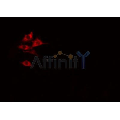 DF3704 staining Hela by IF/ICC. The sample were fixed with PFA and permeabilized in 0.1% Triton X-100,then blocked in 10% serum for 45 minutes at 25¡ãC. The primary antibody was diluted at 1/200 and incubated with the sample for 1 hour at 37¡ãC. An  Alexa Fluor 594 conjugated goat anti-rabbit IgG (H+L) Ab, diluted at 1/600, was used as the secondary antibod