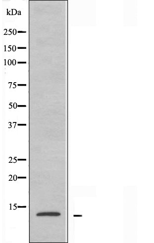 DF3707 at 1/100 staining Human lung tissue by IHC-P. The sample was formaldehyde fixed and a heat mediated antigen retrieval step in citrate buffer was performed. The sample was then blocked and incubated with the antibody for 1.5 hours at 22¡ãC. An HRP conjugated goat anti-rabbit antibody was used as the secondary