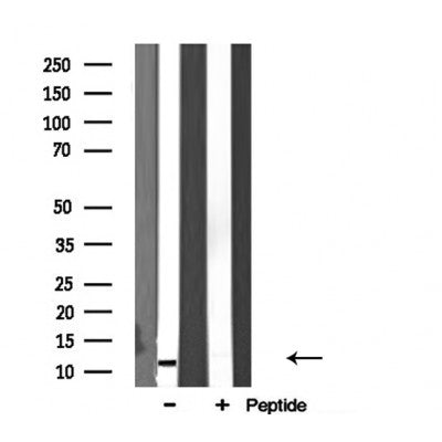 DF3708 staining HepG2 cells by IF/ICC. The sample were fixed with PFA and permeabilized in 0.1% Triton X-100,then blocked in 10% serum for 45 minutes at 25¡ãC. The primary antibody was diluted at 1/200 and incubated with the sample for 1 hour at 37¡ãC. An  Alexa Fluor 594 conjugated goat anti-rabbit IgG (H+L) antibody(Cat.# S0006), diluted at 1/600, was used as secondary antibod
