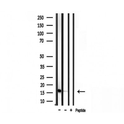 DF3709 staining  293 cells by IF/ICC. The sample were fixed with PFA and permeabilized in 0.1% Triton X-100,then blocked in 10% serum for 45 minutes at 25¡ãC. The primary antibody was diluted at 1/200 and incubated with the sample for 1 hour at 37¡ãC. An  Alexa Fluor 594 conjugated goat anti-rabbit IgG (H+L) antibody(Cat.# S0006), diluted at 1/600, was used as secondary antibod