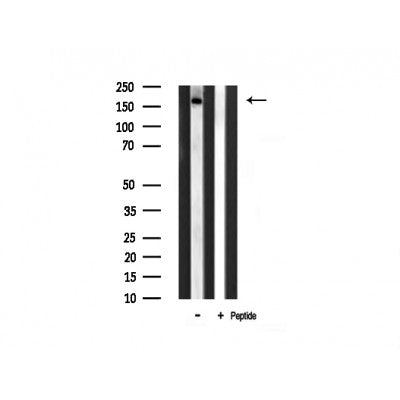 Western blot analysis of FYCO1 expression in Rat spleen lysate