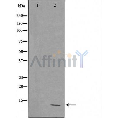 DF3711 staining Hela by IF/ICC. The sample were fixed with PFA and permeabilized in 0.1% Triton X-100,then blocked in 10% serum for 45 minutes at 25¡ãC. The primary antibody was diluted at 1/200 and incubated with the sample for 1 hour at 37¡ãC. An  Alexa Fluor 594 conjugated goat anti-rabbit IgG (H+L) Ab, diluted at 1/600, was used as the secondary antibod